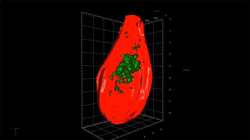 Toxic tau in a neuron Super-resolution microscopy reveals cell body infiltrated with toxic tau