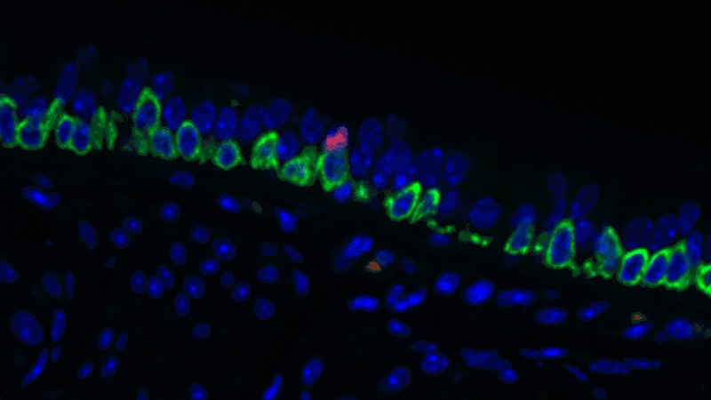 A pulmonary ionocyte