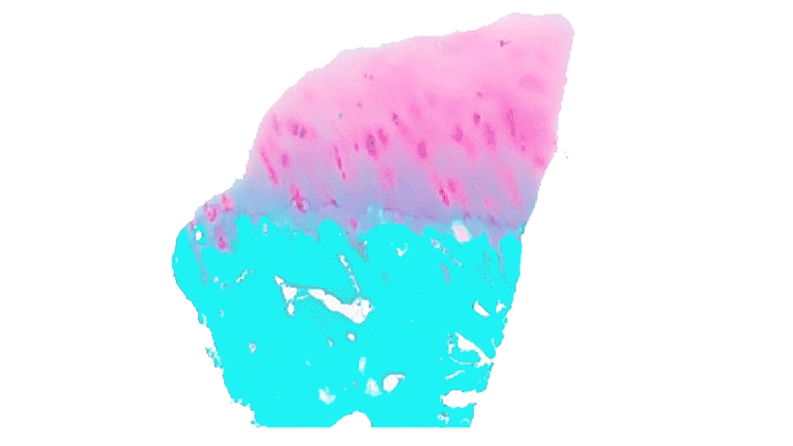 Biopsied cartilage reveals proteins present Biopsied cartilage reveals proteins present