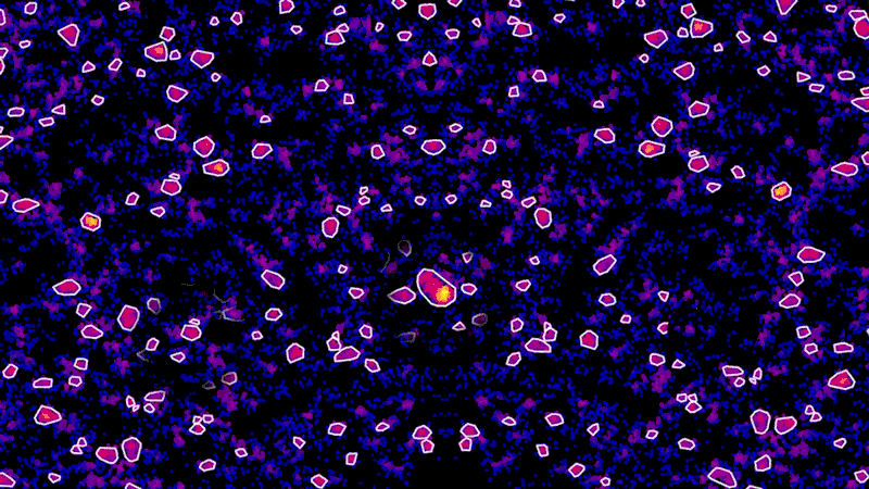 Super-resolution microscopes enable scientists to learn how tau clusters grow.