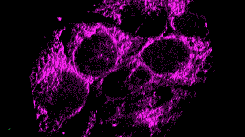 Live cell imaging of inflammation in a tumor model. Live cell imaging of inflammation in a tumor model.