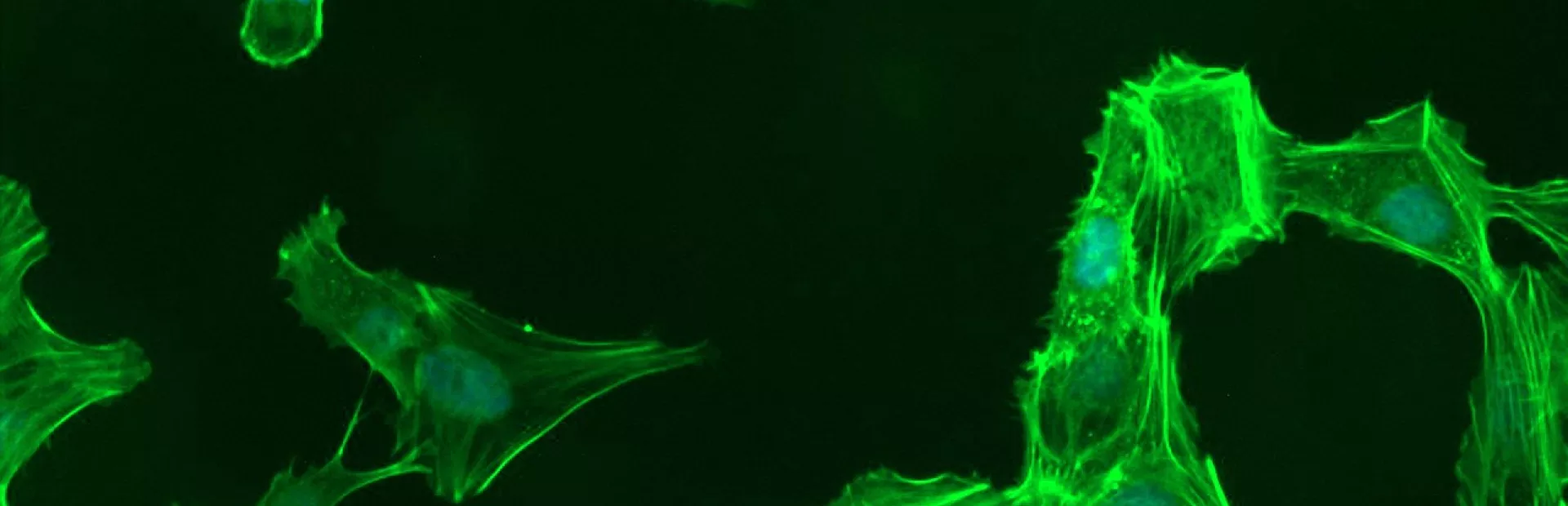 Trabecular meshwork cells
