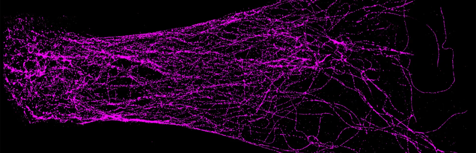 Super-resolution techniques reveal tubulin proteins (purple) in a neuron.
