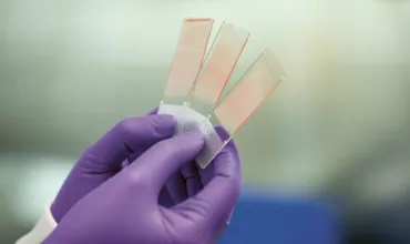 Smear test samples