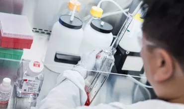 Cell culture Cell culture