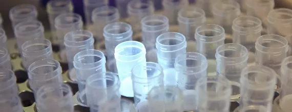 Illuminated samples in lab Illuminated samples in lab