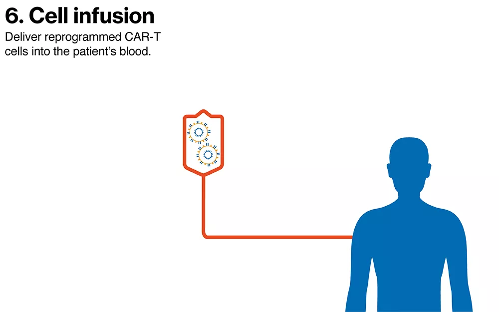 Cell Infusion