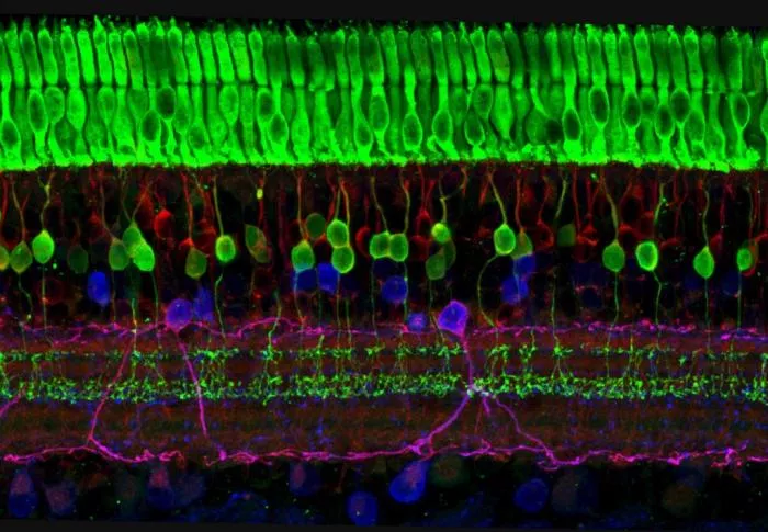 Layers of nerve cells of the retina Layers of nerve cells of the retina