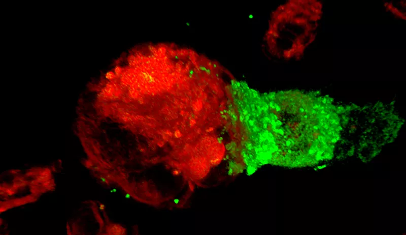 CAR-T cells attack cancer cells