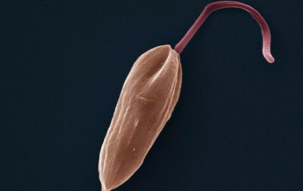 Organism under a microscope Kinetoplastids under a microscope