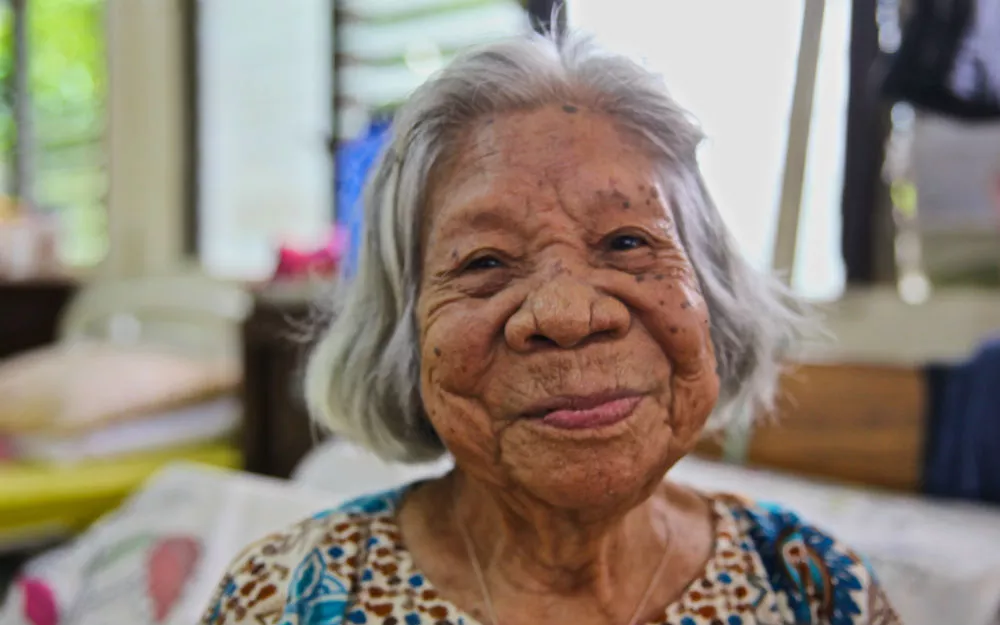 Catalina lives in a hospital due to blindness and nerve damage from leprosy