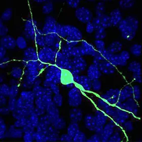 Mutant Protein Spreads Through a Neural Circuit in Huntington’s Disease - Neuron mutant-protein-spreads-through-a-neural-circuit-in-huntingtons-disease-neuron