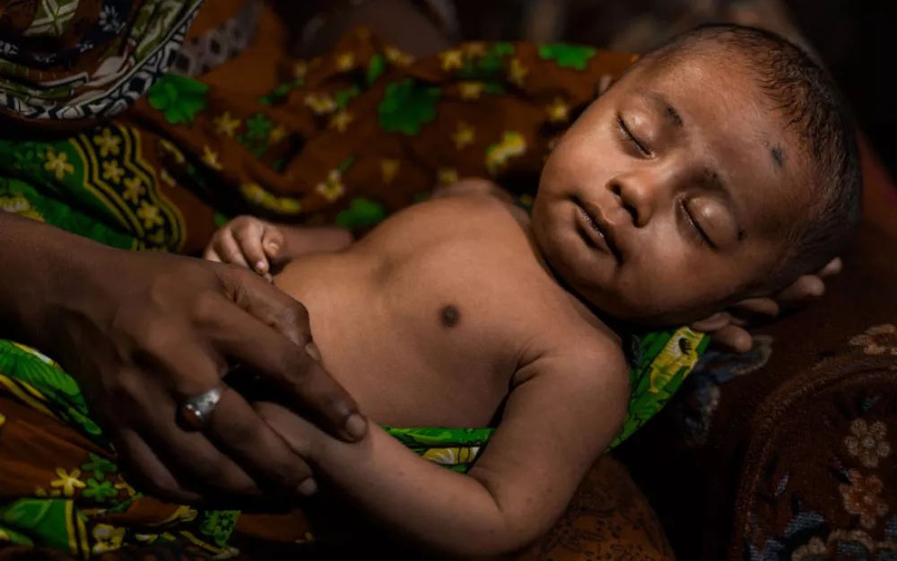 Six-month-old Foysal received treatment for pneumonia at a clinic and hospital in the capital of Bangladesh. Six-month-old Foysal received treatment for pneumonia at a clinic and hospital in the capital of Bangladesh.