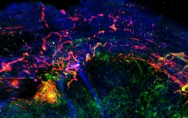 A look inside a tumor A look inside a tumor