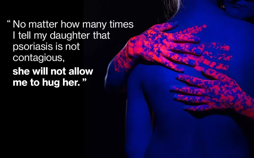 Artistic rendering of a psoriasis patient receiving an embrace