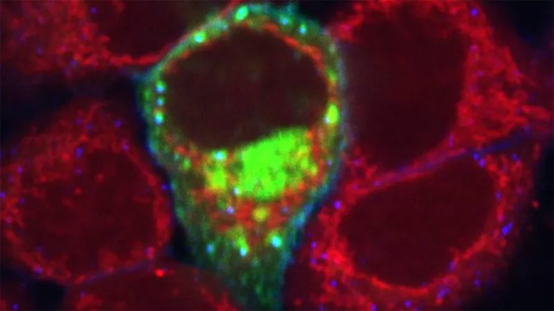 Breast cancer cells. Breast cancer cells.