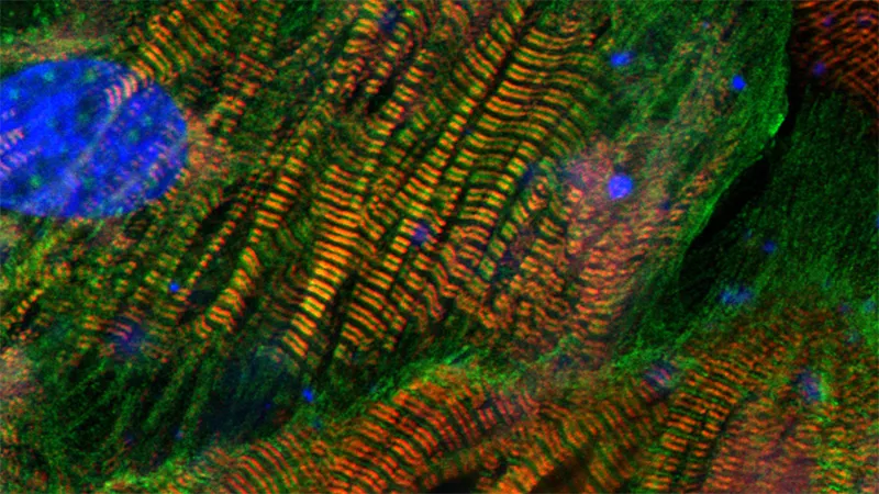 Cardiomyocytes. Heart muscle cells.