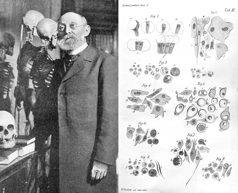 Rudolf Virchow Rudolf Virchow and his scientific drawings
