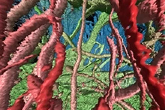 Astrocytes in a brain organoid. Astrocytes in a brain organoid.