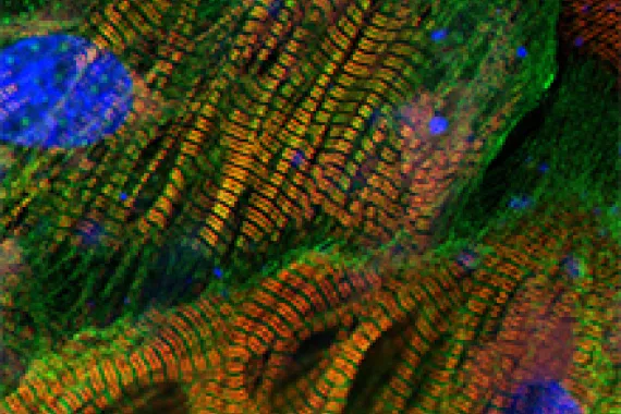 Cardiomyocytes. Heart muscle cells.