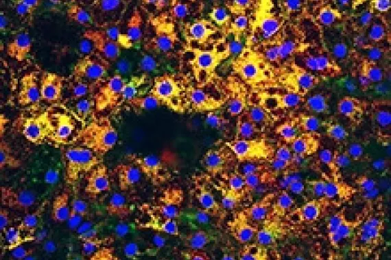 Liver cells Liver cells