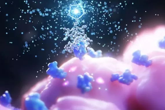 Radioligand therapy