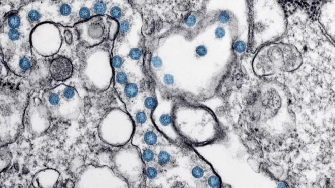 Transmission electron microscopic image of an isolate from a case of coronavirus disease (COVID-19)