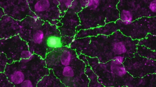 Eye disease tracked to a glitch in starburst cells