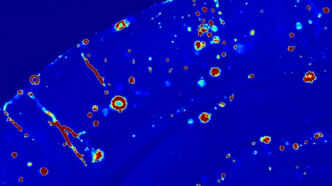 Getting down to the roots of Alzheimer’s disease