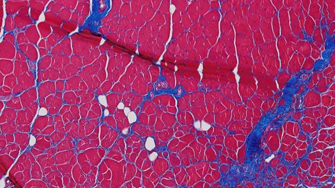 Novartis antibody increases muscle growth in mice and human cell cultures
