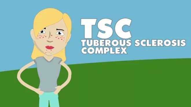 Managing the TSC Transition to Adult Care