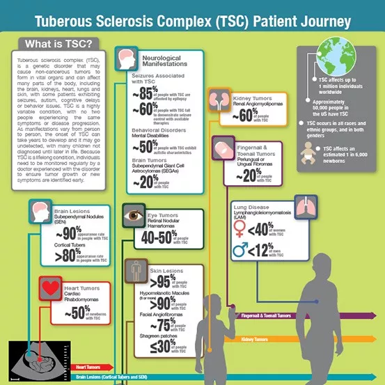 TSC Patient Journey Infographic TSC Patient Journey Infographic